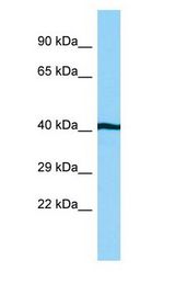 AHSA1 / AHA1 Antibody - AHSA1 / AHA1 antibody Western Blot of Jurkat.  This image was taken for the unconjugated form of this product. Other forms have not been tested.