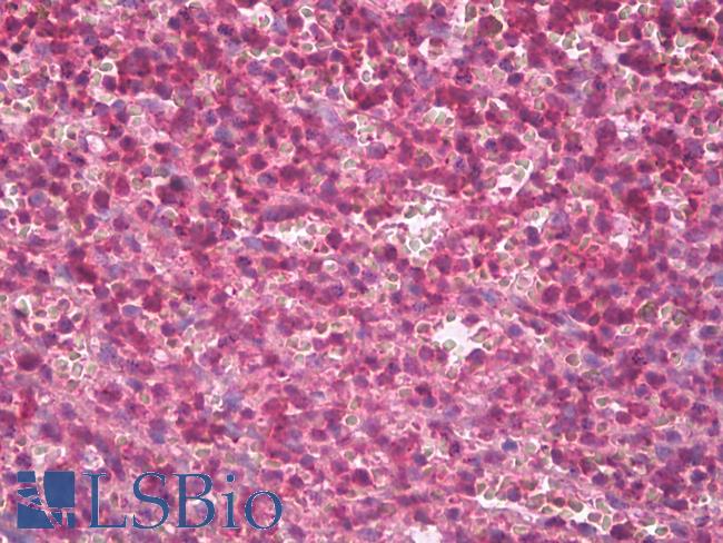 AHSA1 / AHA1 Antibody - Anti-AHSA1 / AHA1 antibody IHC of human spleen. Immunohistochemistry of formalin-fixed, paraffin-embedded tissue after heat-induced antigen retrieval. Antibody dilution 1:200.  This image was taken for the unconjugated form of this product. Other forms have not been tested.