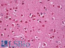AHSA1 / AHA1 Antibody - Anti-AHSA1 / AHA1 antibody IHC of human brain, cortex neurons. Immunohistochemistry of formalin-fixed, paraffin-embedded tissue after heat-induced antigen retrieval. Antibody dilution 1:200.  This image was taken for the unconjugated form of this product. Other forms have not been tested.