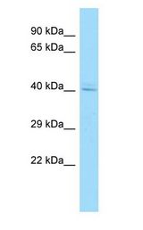 AHSA1 / AHA1 Antibody - AHSA1 / AHA1 antibody Western Blot of MCF7.  This image was taken for the unconjugated form of this product. Other forms have not been tested.