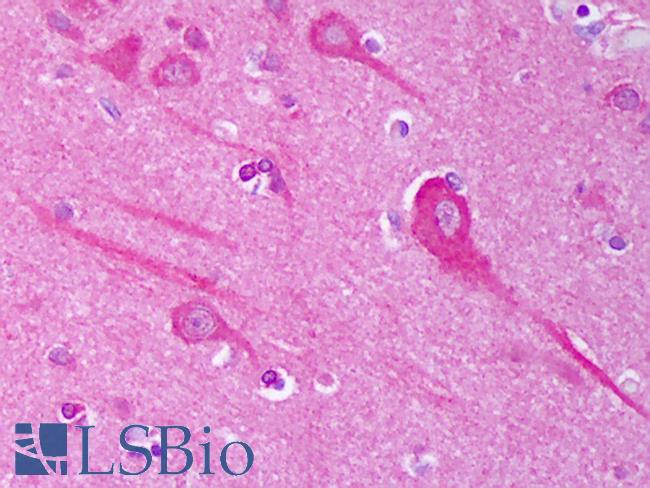 AHSA1 / AHA1 Antibody - Anti-AHSA1 / AHA1 antibody IHC of human brain, cortex neurons. Immunohistochemistry of formalin-fixed, paraffin-embedded tissue after heat-induced antigen retrieval. Antibody concentration 5 ug/ml.  This image was taken for the unconjugated form of this product. Other forms have not been tested.