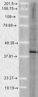 AHSA1 / AHA1 Antibody - Western blot analysis of Aha1 in a human cell line mix, using a 1:1000 dilution of AHSA1 / AHA1 antibody.  This image was taken for the unconjugated form of this product. Other forms have not been tested.