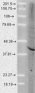 AHSA1 / AHA1 Antibody - Western blot analysis of Aha1 in a human cell line mix, using a 1:1000 dilution of AHSA1 / AHA1 antibody.  This image was taken for the unconjugated form of this product. Other forms have not been tested.