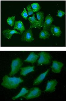 AHSA1 / AHA1 Antibody - ICC/IF analysis of AHA1 in Hep3B cells line, stained with DAPI (Blue) for nucleus staining and monoclonal anti-human AHA1 antibody (1:100) with goat anti-mouse IgG-Alexa fluor 488 conjugate (Green).ICC/IF analysis of AHA1 in A549 cells line, stained with DAPI (Blue) for nucleus staining and monoclonal anti-human AHA1 antibody (1:100) with goat anti-mouse IgG-Alexa fluor 488 conjugate (Green).