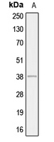 AHSA1 / AHA1 Antibody - Western blot analysis of AHA1 expression in HepG2 (A) whole cell lysates.