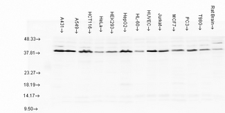 AHSA1 / AHA1 Antibody - Aha1, Human cell lines.  This image was taken for the unconjugated form of this product. Other forms have not been tested.