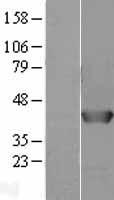 AHSA1 / AHA1 Protein - Western validation with an anti-DDK antibody * L: Control HEK293 lysate R: Over-expression lysate