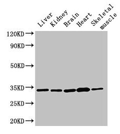 AHSA2 Antibody - Western Blot Positive WB detected in: Rat liver tissue, Rat kidney tissue, Mouse brain tissue, Mouse heart tissue, Mouse skeletal muscle tissue All lanes: AHSA2 antibody at 3µg/ml Secondary Goat polyclonal to rabbit IgG at 1/50000 dilution Predicted band size: 34, 17, 16 kDa Observed band size: 34 kDa