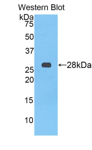 AHSG / Fetuin A Antibody - Western blot of recombinant AHSG / Fetuin.  This image was taken for the unconjugated form of this product. Other forms have not been tested.