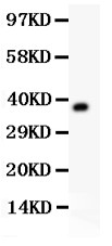 AHSG / Fetuin A Antibody - Fetuin A antibody Western blot. All lanes: Anti Fetuin A at 0.5 ug/ml. WB: Recombinant Mouse Fetuin A Protein 0.5 ng. Predicted band size: 37 kD. Observed band size: 37 kD.