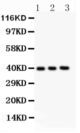 AHSG / Fetuin A Antibody - Fetuin A antibody Western blot. All lanes: Anti Fetuin A at 0.5 ug/ml. Lane 1: NIH3T3 Whole Cell Lysate at 40 ug. Lane 2: NEURO Whole Cell Lysate at 40 ug. Lane 3: Mouse Brain Tissue Lysate at 50 ug. Predicted band size: 39 kD. Observed band size: 39 kD.