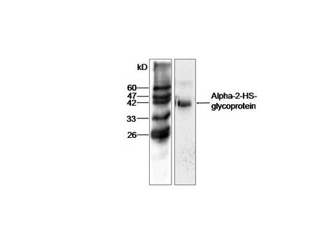 AHSG / Fetuin A Antibody