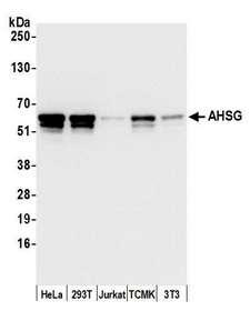 AHSG / Fetuin A Antibody - Detection of human and mouse AHSG by western blot. Samples: Whole cell lysate (15 µg) from HeLa, HEK293T, Jurkat, mouse TCMK-1, and mouse NIH 3T3 cells prepared using NETN lysis buffer. Antibody: Affinity purified rabbit anti-AHSG antibody used for WB at 0.1 µg/ml. Detection: Chemiluminescence with an exposure time of 1 second.