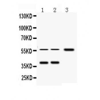 AHSG / Fetuin A Antibody - AHSG antibody Western blot. All lanes: Anti AHSG at 0.5 ug/ml. Lane 1: Rat Brain Tissue Lysate at 50 ug. Lane 2: RH35 Whole Cell Lysate at 40 ug. Lane 3: MCF-7 Whole Cell Lysate at 40 ug. Predicted band size: 39 kD. Observed band size: 39 kD, 58 kD.