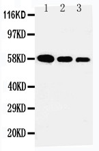 AHSG / Fetuin A Antibody - WB of AHSG / Fetuin antibody. All lanes: Anti-AHSG at 0.5ug/ml. Lane 1: Recombinant Human Fetuin A Protein 10ng. Lane 2: Recombinant Human Fetuin A Protein 5ng. Lane 3: Recombinant Human Fetuin A Protein 2.5ng. Predicted bind size: 58KD. Observed bind size: 58KD.