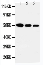 AHSG / Fetuin A Antibody - Anti-Fetuin A antibody, Western blotting Lane 1: Recombinant Human Fetuin A Protein 10ng Lane 2: Recombinant Human Fetuin A Protein 5ng Lane 3: Recombinant Human Fetuin A Protein 2. 5ng