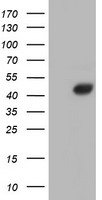 AHSG / Fetuin A Antibody - HEK293T cells were transfected with the pCMV6-ENTRY control (Left lane) or pCMV6-ENTRY AHSG (Right lane) cDNA for 48 hrs and lysed. Equivalent amounts of cell lysates (5 ug per lane) were separated by SDS-PAGE and immunoblotted with anti-AHSG.