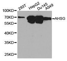AHSG / Fetuin A Antibody - Western blot of extracts of various cell lines, using AHSG antibody.