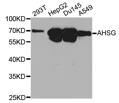 AHSG / Fetuin A Antibody - Western blot analysis of extracts of various cell lines, using AHSG antibody at 1:1000 dilution. The secondary antibody used was an HRP Goat Anti-Rabbit IgG (H+L) at 1:10000 dilution. Lysates were loaded 25ug per lane and 3% nonfat dry milk in TBST was used for blocking.