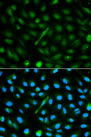 AHSG / Fetuin A Antibody - Immunofluorescence analysis of MCF-7 cells using AHSG antibody. Blue: DAPI for nuclear staining.