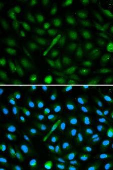 AHSG / Fetuin A Antibody - Immunofluorescence analysis of MCF-7 cells using AHSG antibody. Blue: DAPI for nuclear staining.