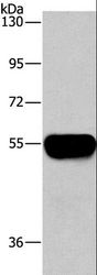 AHSG / Fetuin A Antibody - Western blot analysis of Human plasma tissue, using AHSG Polyclonal Antibody at dilution of 1:1450.