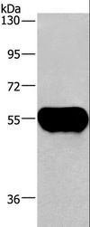 AHSG / Fetuin A Antibody - Western blot analysis of Human plasma tissue, using AHSG Polyclonal Antibody at dilution of 1:1350.