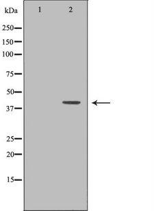 AHSG / Fetuin A Antibody - Western blot analysis of mouse liver tissue lysates using AHSG antibody. The lane on the left is treated with the antigen-specific peptide.