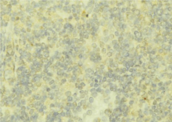 AHSG / Fetuin A Antibody - 1:100 staining mouse liver tissue by IHC-P. The sample was formaldehyde fixed and a heat mediated antigen retrieval step in citrate buffer was performed. The sample was then blocked and incubated with the antibody for 1.5 hours at 22°C. An HRP conjugated goat anti-rabbit antibody was used as the secondary.