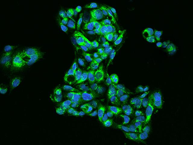 AHSG / Fetuin A Antibody - Immunofluorescence staining of Fetuin A in HepG2 cells. Cells were fixed with 4% PFA, permeabilzed with 0.1% Triton X-100 in PBS, blocked with 10% serum, and incubated with rabbit anti-Human Fetuin A polyclonal antibody (dilution ratio 1:200) at 4°C overnight. Then cells were stained with the Alexa Fluor 488-conjugated Goat Anti-rabbit IgG secondary antibody (green) and counterstained with DAPI (blue). Positive staining was localized to Cytoplasm.