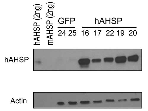AHSP / EDRF Antibody - Western Blot of rabbit anti-AHSP antibody. Lane 1: Recombinant hAHSP (2 ng). Lane 2: Recombinant mAHSP (2 ng). Lane 3: RBC Lysates Mouse #24 - GFP. Lane 4: RBC Lysates Mouse #25 - GFP. Lane 5: RBC Lysates Mouse #16 - hAHSP. Lane 6: RBC Lysates Mouse #17 - hAHSP. Lane 7: RBC Lysates Mouse #22 - hAHSP. Lane 8: RBC Lysates Mouse #19 - hAHSP. Lane 9: RBC Lysates Mouse #20 - hAHSP. Load: if not described differently, 10 ng per lane. Primary antibody: hAHSP antibody, Beta-Actin antibody at 1:1,000 for overnight at 4°C. Secondary antibody: HRP Streptavidin secondary antibody at 1:40,000 for 30 min at RT. Block: 5% dry milk 30 min at RT. Predicted/Observed size: ~12kDa. Other band(s): none.