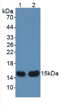 AHSP / EDRF Antibody - Western Blot; Sample: Lane1: Rat Liver Tissue; Lane2: Mouse Liver Tissue.