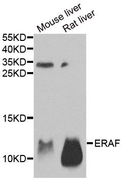 AHSP / EDRF Antibody - Western blot analysis of extracts of various tissues.