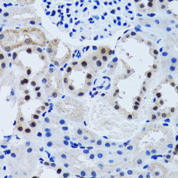 AHSP / EDRF Antibody - Immunohistochemistry of paraffin-embedded mouse kidney tissue.