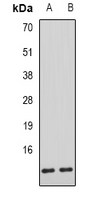 AHSP / EDRF Antibody - Western blot analysis of AHSP expression in mouse liver (A); rat liver (B) whole cell lysates.