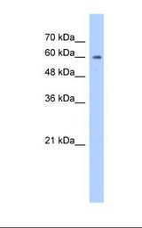 AICAR / ATIC Antibody - HepG2 cell lysate. Antibody concentration: 1.25 ug/ml. Gel concentration: 12%.  This image was taken for the unconjugated form of this product. Other forms have not been tested.