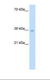 AICAR / ATIC Antibody - Jurkat cell lysate. Antibody concentration: 5.0 ug/ml. Gel concentration: 12%.  This image was taken for the unconjugated form of this product. Other forms have not been tested.