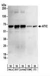 AICAR / ATIC Antibody - Detection of Human ATIC by Western Blot. Samples: Whole cell lysate (50 ug) from HeLa, 293T, Jurkat, mouse TCMK-1, and mouse NIH3T3 cells. Antibodies: Affinity purified rabbit anti-ATIC antibody used for WB at 0.1 ug/ml. Detection: Chemiluminescence with an exposure time of 30 seconds.