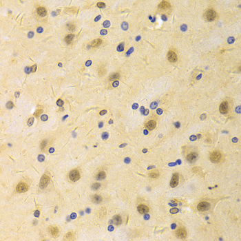 AICAR / ATIC Antibody - Immunohistochemistry of paraffin-embedded rat brain tissue.