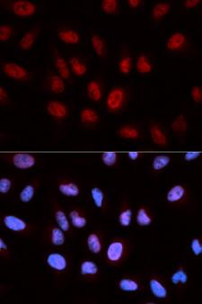 AICAR / ATIC Antibody - Immunofluorescence analysis of U20S cells.