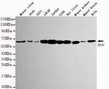 AICAR / ATIC Antibody - Western blot detection of ATIC in various tissues and cell lysates using ATIC mouse monoclonal antibody (1:1000 dilution). Predicted band size: 64KDa. Observed band size:64KDa.