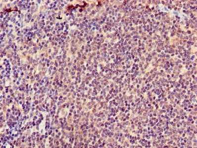 AICAR / ATIC Antibody - Immunohistochemistry of paraffin-embedded human lymph node tissue using ATIC Antibody at dilution of 1:100