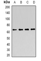 AICAR / ATIC Antibody - Western blot analysis of ATIC expression in MCF7 (A); HepG2 (B); HT29 (C); K562 (D) whole cell lysates.