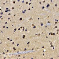 AICAR / ATIC Antibody - Immunohistochemical analysis of ATIC staining in rat brain formalin fixed paraffin embedded tissue section. The section was pre-treated using heat mediated antigen retrieval with sodium citrate buffer (pH 6.0). The section was then incubated with the antibody at room temperature and detected using an HRP conjugated compact polymer system. DAB was used as the chromogen. The section was then counterstained with hematoxylin and mounted with DPX.