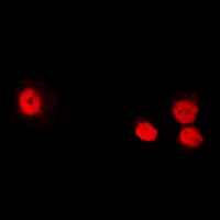 AICAR / ATIC Antibody - Immunofluorescent analysis of ATIC staining in U2OS cells. Formalin-fixed cells were permeabilized with 0.1% Triton X-100 in TBS for 5-10 minutes and blocked with 3% BSA-PBS for 30 minutes at room temperature. Cells were probed with the primary antibody in 3% BSA-PBS and incubated overnight at 4 deg C in a humidified chamber. Cells were washed with PBST and incubated with a DyLight 594-conjugated secondary antibody (red) in PBS at room temperature in the dark.