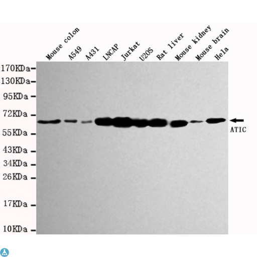 AICAR / ATIC Antibody - Western blot detection of ATIC in various tissues and cell lysates using ATIC mouse mAb (1:1000 diluted). Predicted band size: 64KDa. Observed band size: 64KDa.
