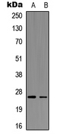 AICDA / AID Antibody - Western blot analysis of AID expression in HEK293T (A); PC12 (B) whole cell lysates.