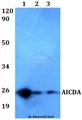 AICDA / AID Antibody - Western blot of AICDA antibody at 1:500 dilution. Lane 1: MCF-7 whole cell lysate. Lane 2: sp2/0 whole cell lysate. Lane 3: PC12 whole cell lysate.