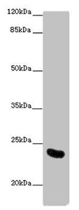 AICDA / AID Antibody - Western blot All Lanes: AICDA antibody at 10 ug/ml+ Mouse liver tissue Secondary Goat polyclonal to rabbit IgG at 1/10000 dilution Predicted band size: 24,23 kDa Observed band size: 24 kDa