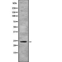 AICDA / AID Antibody - Western blot analysis of AICDA using COLO205 whole lysates.
